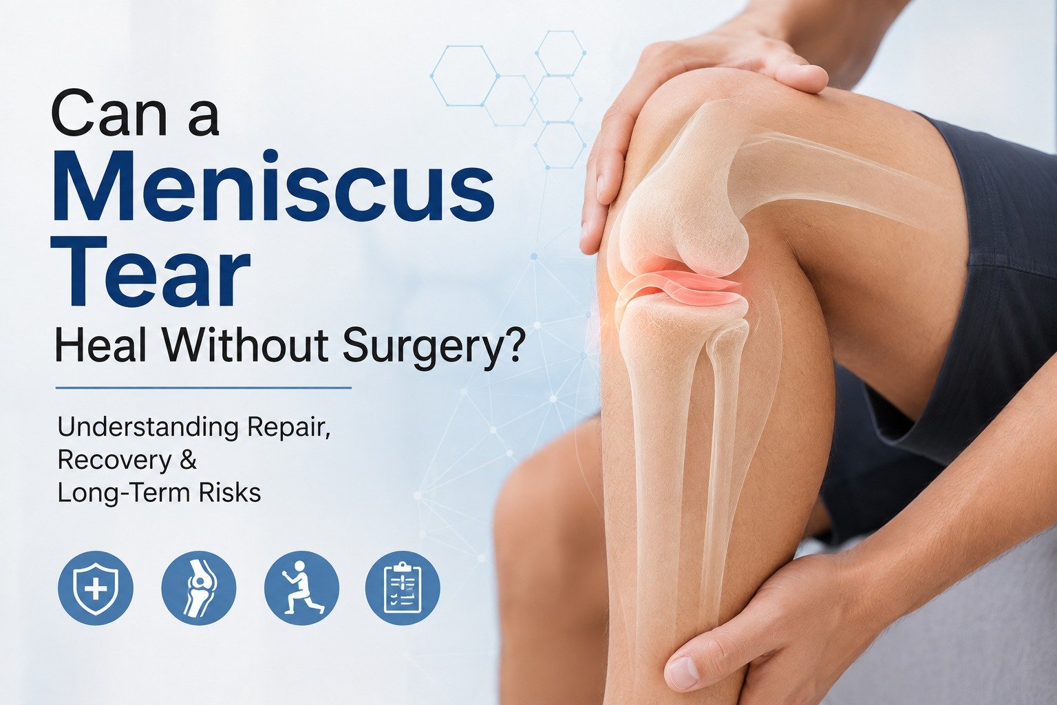 Can a Meniscus Tear Heal Without Surgery? Understanding Repair, Recovery & Long-Term Risks