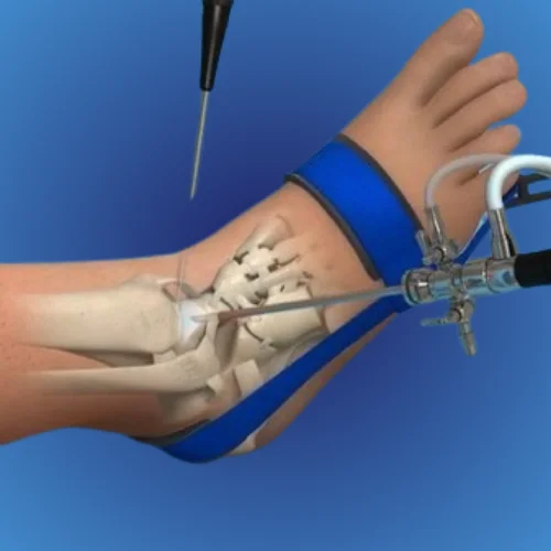Arthroscopy Image 1
