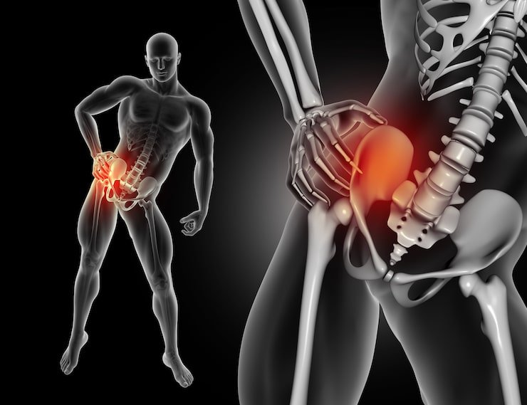 Hip Labral Tear: Causes, Symptoms & Treatment
