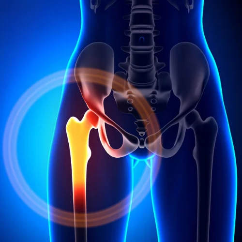 Arthroscopy Image 1