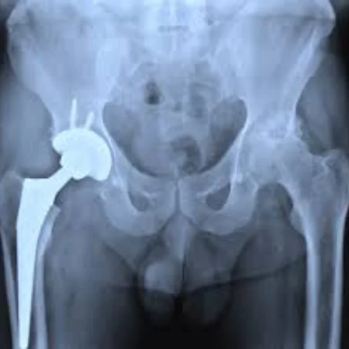 Arthroscopy Image 3